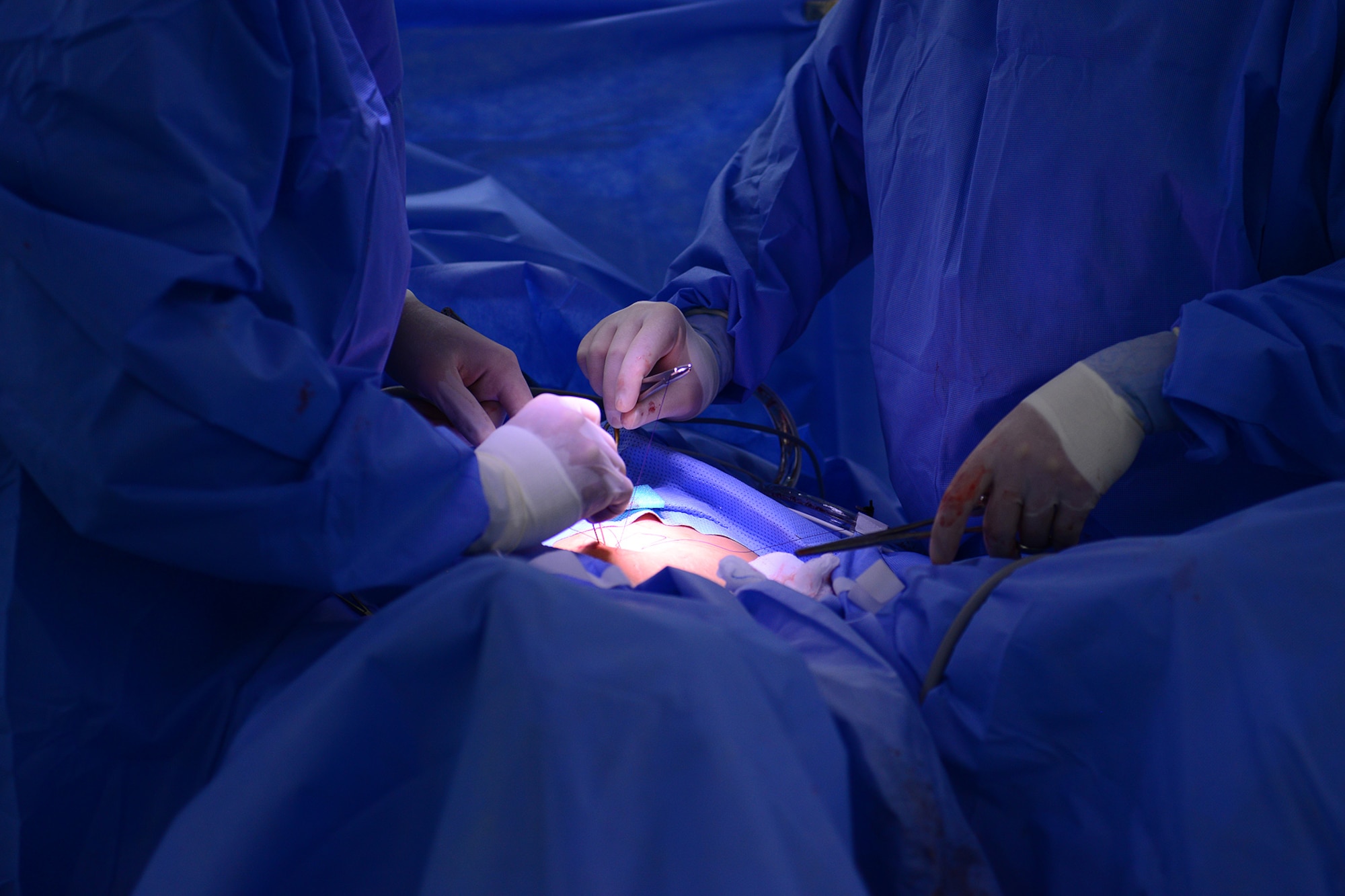U.S. Air Force Maj. Arthur Greenwood and Capt. Stuart Winkler, 633rd Medical Operations Squadron obstetricians, stitch up an incision after performing a hysterectomy at Langley Air Force Bae, Va., June 14, 2016. With the new 3-D laparoscopic technology at Langley, incisions are smaller, which allows faster heal times.  (U.S. Air Force photo by Staff Sgt. Ciara Gosier)