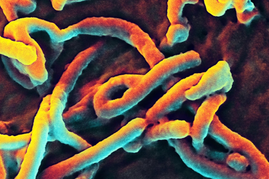 Ebola virus budding from the surface of a Vero cell.