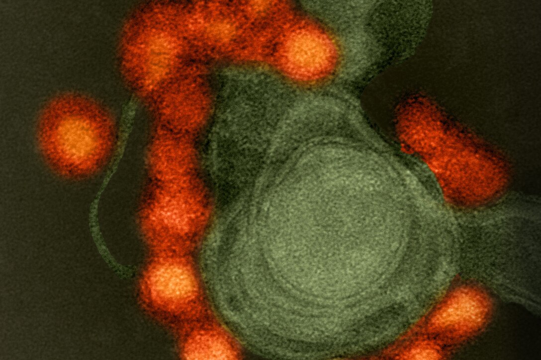A transmission electron microscope image shows a negative-stained, Fortaleza-strain Zika virus (red) isolated from a microcephaly case in Brazil. The Walter Reed Army Institute of Research is developing a vaccine against the Zika virus in coordination with federal partners, including the Biomedical Advanced Research and Development Authority of the Department of Health and Human Services and the National Institutes of Health's National Institute of Allergy and Infectious Diseases. National Institutes of Health photo