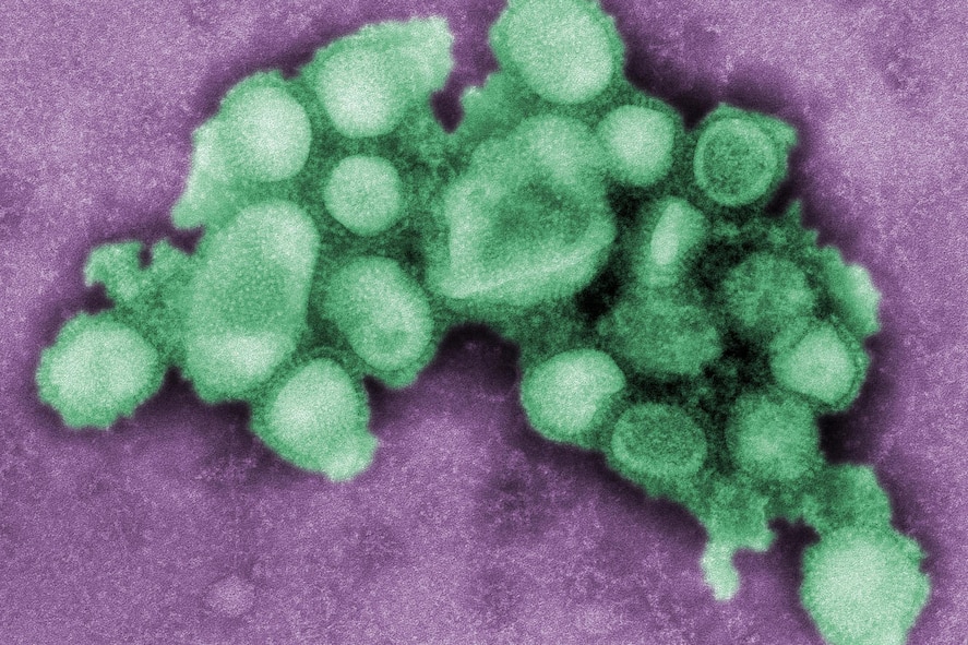 This colorized transmission electron micrograph created in 2009 shows the H1N1 pandemic flu virus.