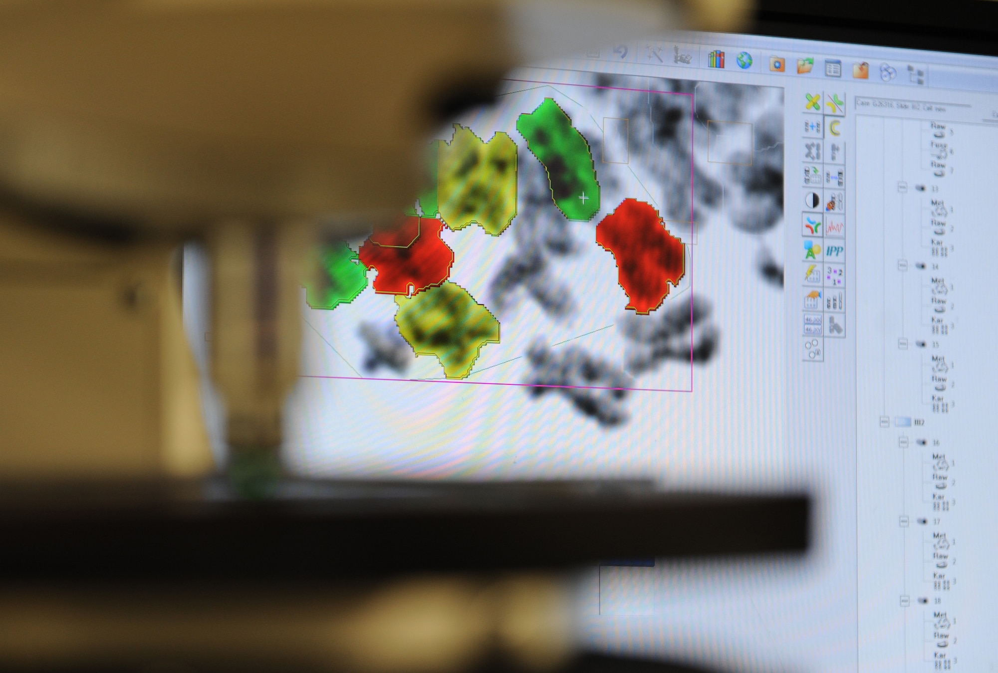 Patient chromosomes are displayed onscreen for Ben Dudte, 81st Medical Operations Squadron cytogenetic technologist,  to analyze the 81st Medical Group’s genetics center Mar. 16, 2016, Keesler Air Force Base, Miss. The Air Force Medical Genetics Center is the only laboratory of its kind in the entire Defense Department. Made up of the cytogenetics and molecular genetics labs, the center is focused on providing clinical and laboratory diagnostic services to support all DOD facilities worldwide. (U.S. Air Force photo by Kemberly Groue)