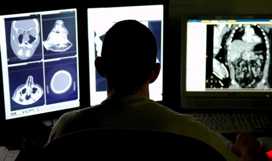 Maj. Michael Matchette, a 332nd Expeditionary Medical Support Squadron radiologist, reviews CT scans from a trauma patient to determine the severity of the injuries at the Air Force Theater Hospital in Balad Air Base, Iraq, Feb. 20, 2016. The CT scan process goes directly from the scanning machine to the computer, which allows doctors to diagnose medical problems faster. (U.S. Air Force photo/Senior Airman Julianne Showalter)