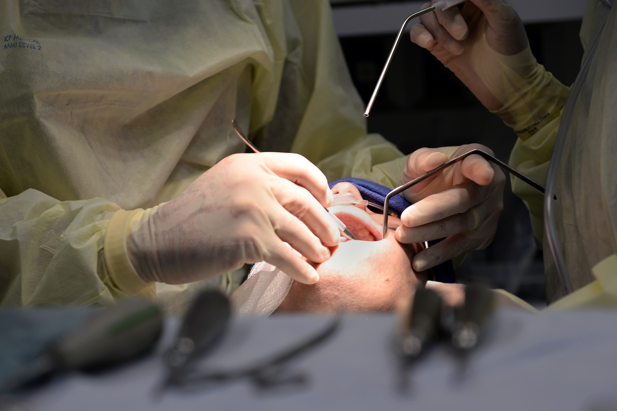 U.S. Air Force Airmen assigned to the 633rd Medical Group, perform oral surgery at Langley Air Force Base, Va., March 17, 2016. In addition to wisdom teeth removal, Langley’s oral surgeons can perform corrective jaw surgery, obstructive sleep apnea surgery, bone grafting, repair of complex lacerations of the head and neck and soft-tissue biopsies of the face. (U.S. Air Force photo by Airman 1st Class Kaylee Dubois)