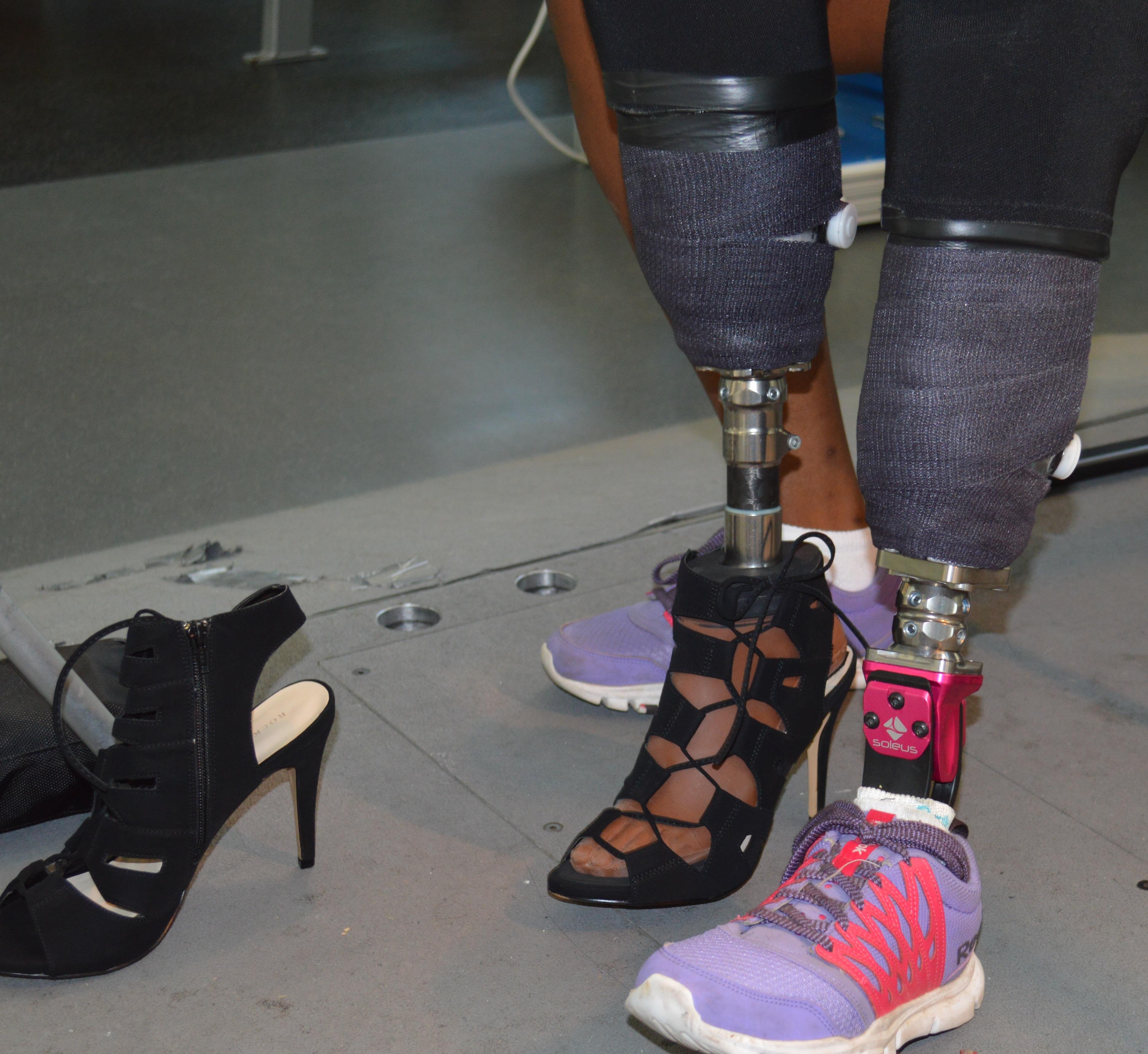 Women face unique challenges when getting a prosthesis > Joint