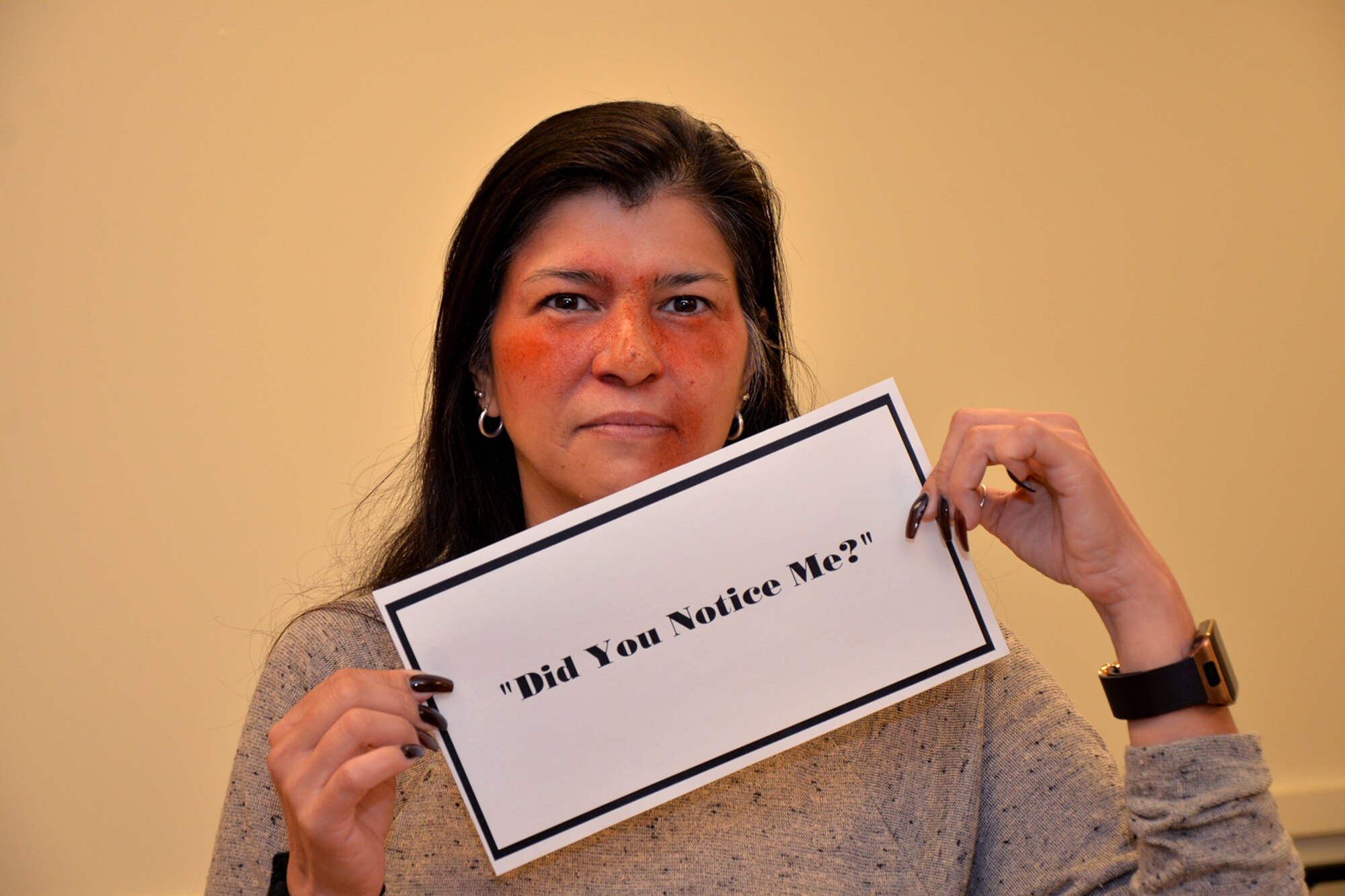 Wearing moulage, Sandra Maldanado, 17th Mission Support Group financial and computer support specialist, holds a sign during the Black Eye Campaign at Goodfellow Air Force Base, Texas, Oct. 21, 2016. “Did you notice me?,” is the theme for this year’s Black Eye Campaign. (U.S. Air Force photo by Airman 1st Class Randall Moose/Released)