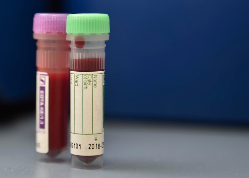 Blood samples from a military working dog wait to be tested at the Joint Base Charleston Veterinary Treatment Facility, Oct. 18, 2016. The JB Charleston Veterinary Treatment Facility provides care to military working dogs and conducts quarterly training with the military working dog handlers on emergency procedures and first aid for their dog when they deploy.