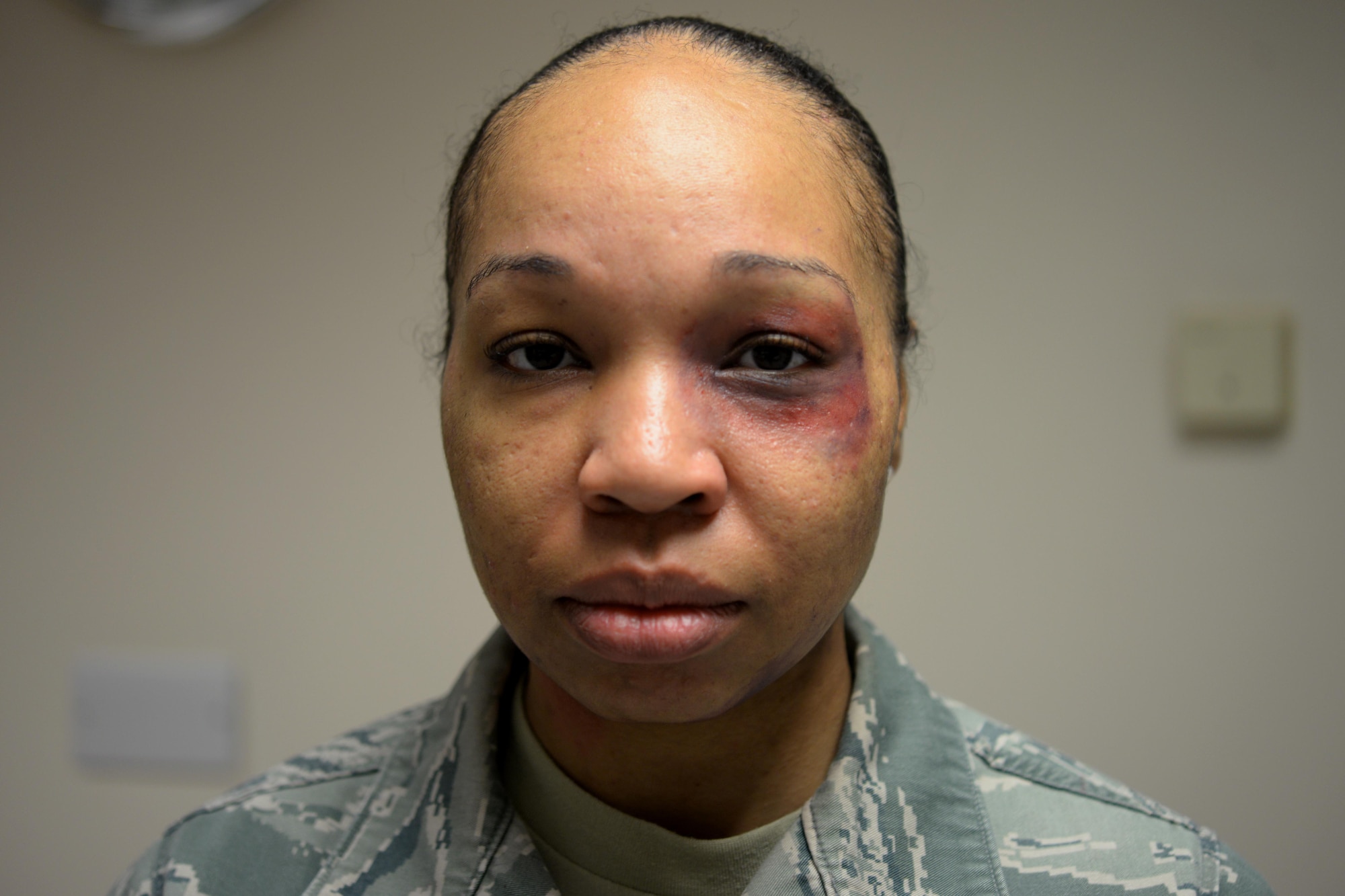 A volunteer from the 48th Logistics Readiness Squadron poses for a portrait at Royal Air Force Lakenheath, England, Oct. 21, after having a simulated bruise applied to her eye . The bruise was applied as part of this year’s Black Eye Campaign, an event put on to raise awareness for domestic violence. (U.S. Air Force photo/Airman 1st Class Eli Chevalier) 