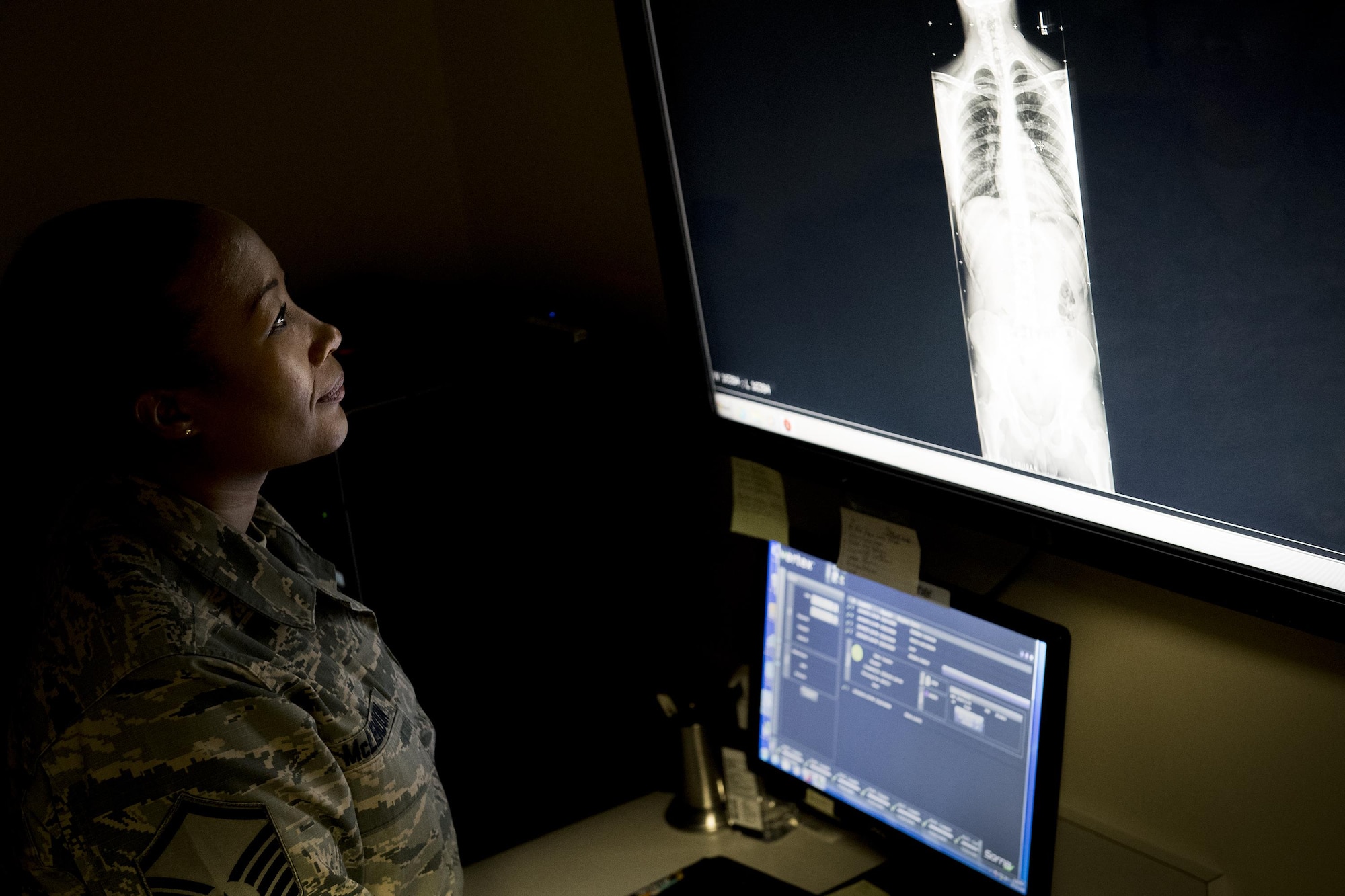 Master Sgt. Tracey McLendon, 23d Medical Support Squadron flight chief of diagnostic imaging, reads an X-ray, Oct. 24, 2016, at Moody Air Force Base, Ga. A simple broken bone could potentially become deadly if bone fragments damage organs. When the radiology section reviews their X-rays, they search for any abnormalities. (U.S. Air Force photo by Airman 1st Class Daniel Snider)
