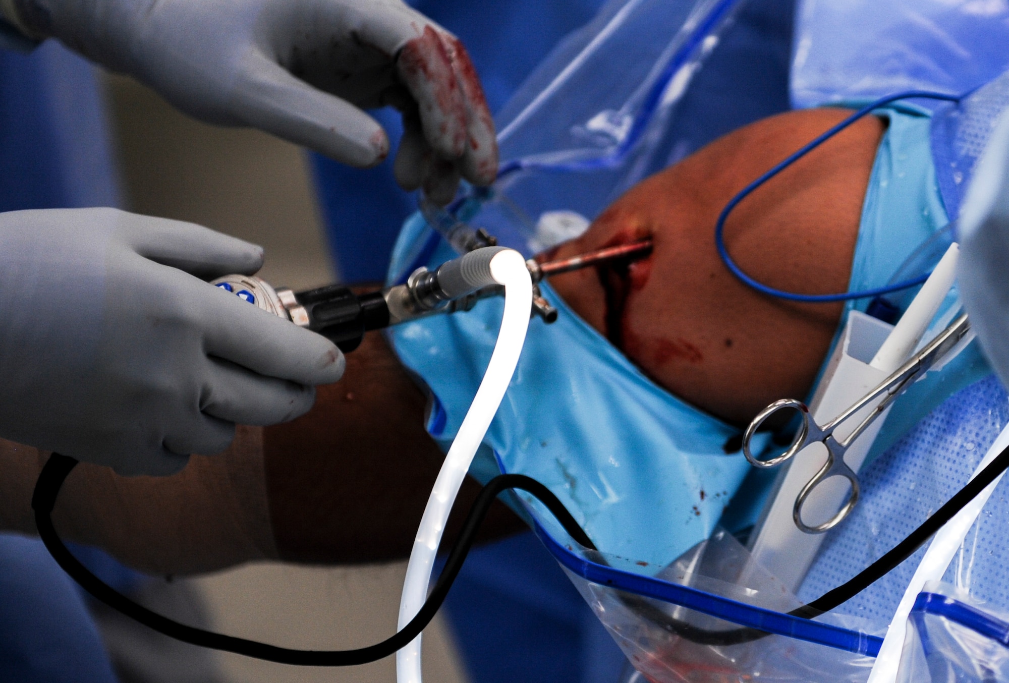 Maj. Ryan Swope, 99th Surgical Operations Squadron orthopedic surgeon, uses a scope to look inside an Airman’s knee during an ACL surgery at the Mike O’Callaghan Federal Medical Center on Nellis Air Force Base, Nev., Oct. 17, 2016. A large number of surgeries come from Airmen who have suffered injuries while participating in sports or physical activities. (U.S. Air Force photo by Airman 1st Class Kevin Tanenbaum/Released)