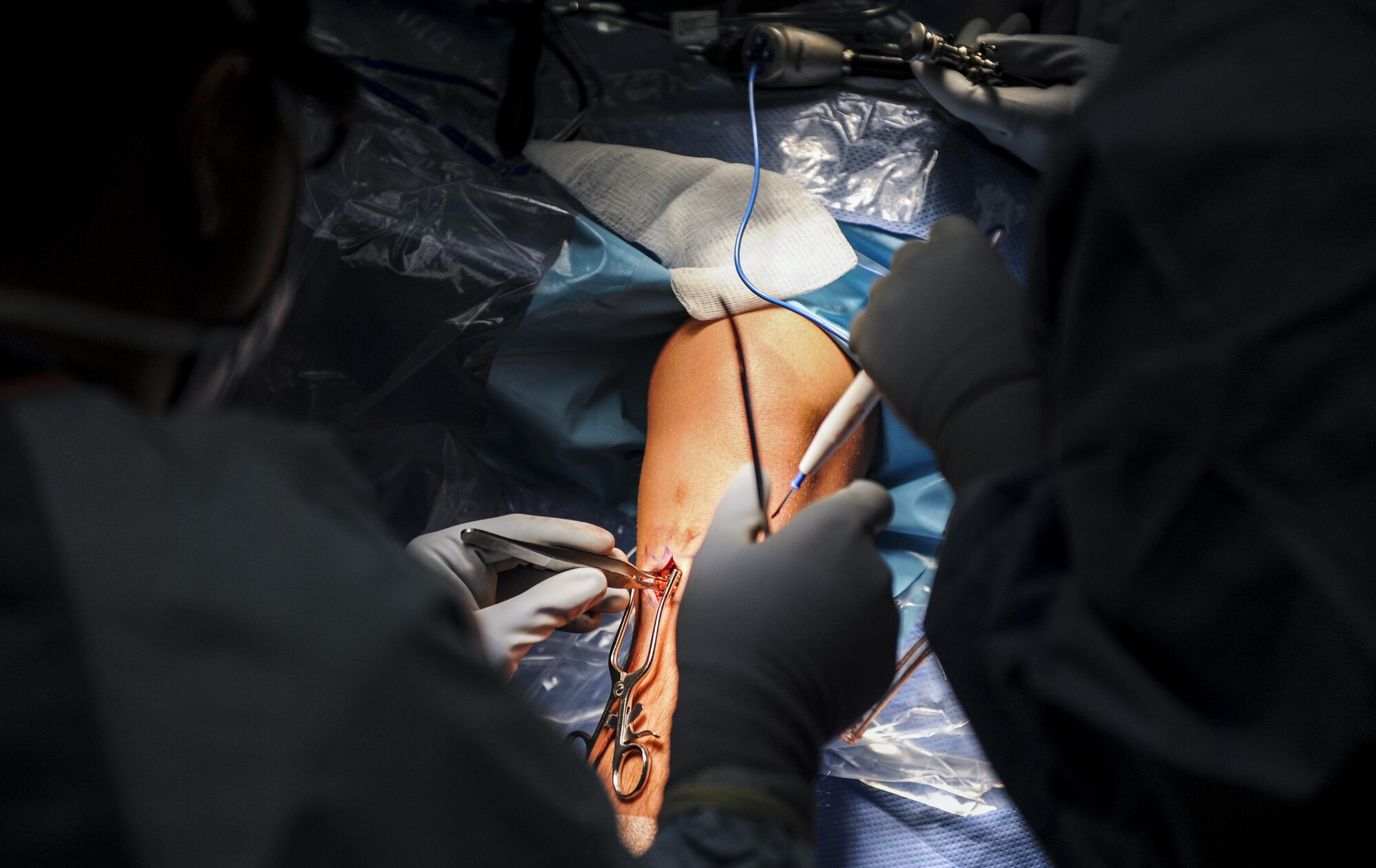Maj. Ryan Swope, 99th Surgical Operations Squadron orthopedic surgeon, makes an incision during a surgery to repair an Airman’s ACL at the Mike O’Callaghan Federal Medical Center on Nellis Air Force Base, Nev., Oct. 17, 2016. The 99th Surgical Operations Squadron goal is to get Airmen back to their mission by providing surgical services in any manner that they need in. (U.S. Air Force photo by Airman 1st Class Kevin Tanenbaum/Released)