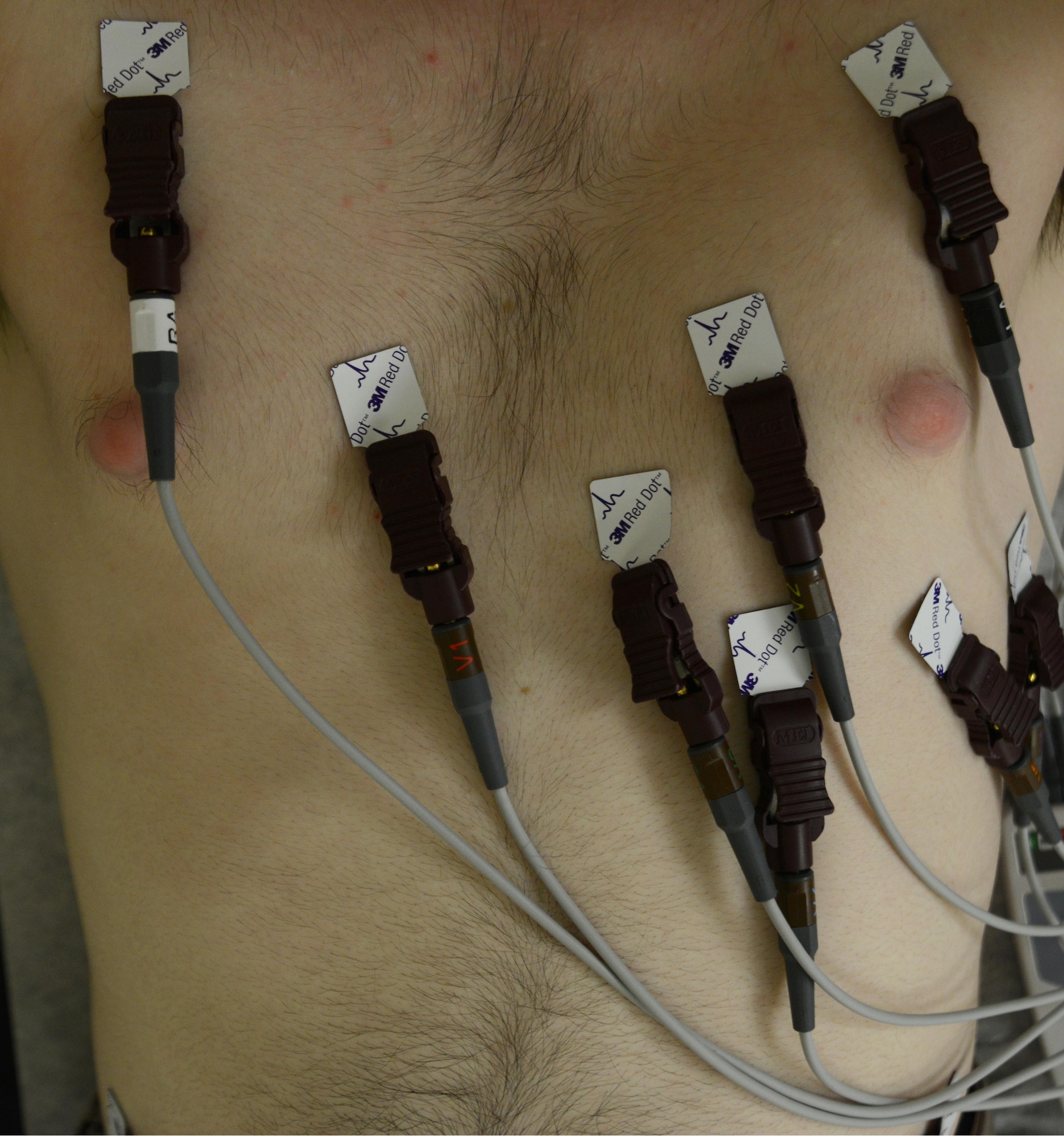A patient receives an electrocardiogram to determine if he has atrial fibrillation at the cardiopulmonary clinic at the Joint Base Elmendorf-Richardson hospital, Alaska, Sept. 6, 2016. An electrocardiogram tests the sinus rhythm of the heart through electric waves and is the most common practice because A-fib is a disease that causes abnormalities in the flow of electricity in the heart.