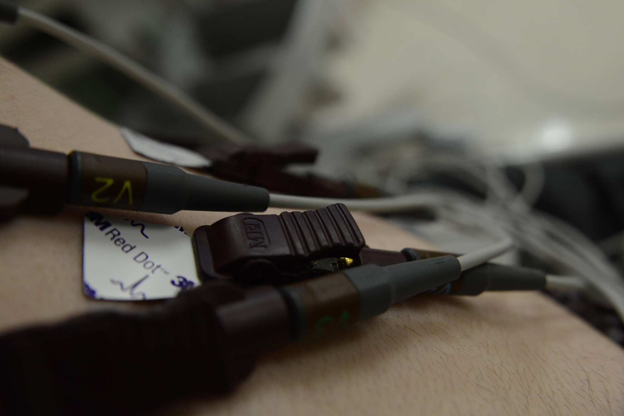 A patient receives an electrocardiogram to determine if he has atrial fibrillation at the cardiopulmonary clinic at the Joint Base Elmendorf-Richardson hospital, Alaska, Sept. 6, 2016. An electrocardiogram tests the sinus rhythm of the heart through electric waves and is the most common practice because A-fib is a disease that causes abnormalities in the flow of electricity in the heart. 