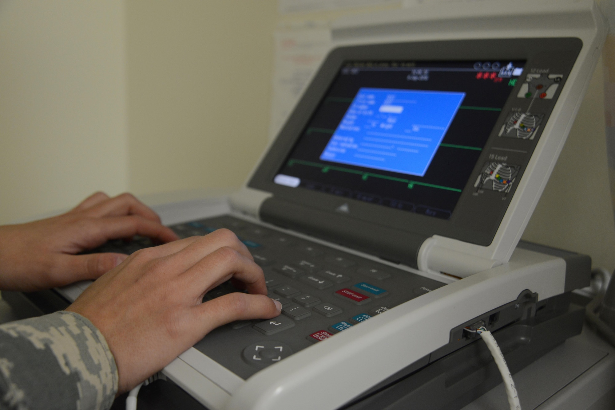 A cardiology journeyman logs the data from an electrocardiogram at the cardiopulmonary clinic at the Joint Base Elmendorf-Richardson hospital, Alaska, Sept. 6, 2016. An electrocardiogram tests the sinus rhythm of the heart through electric waves and is the most common practice because A-fib is a disease that causes abnormalities in the flow of electricity in the heart. 
