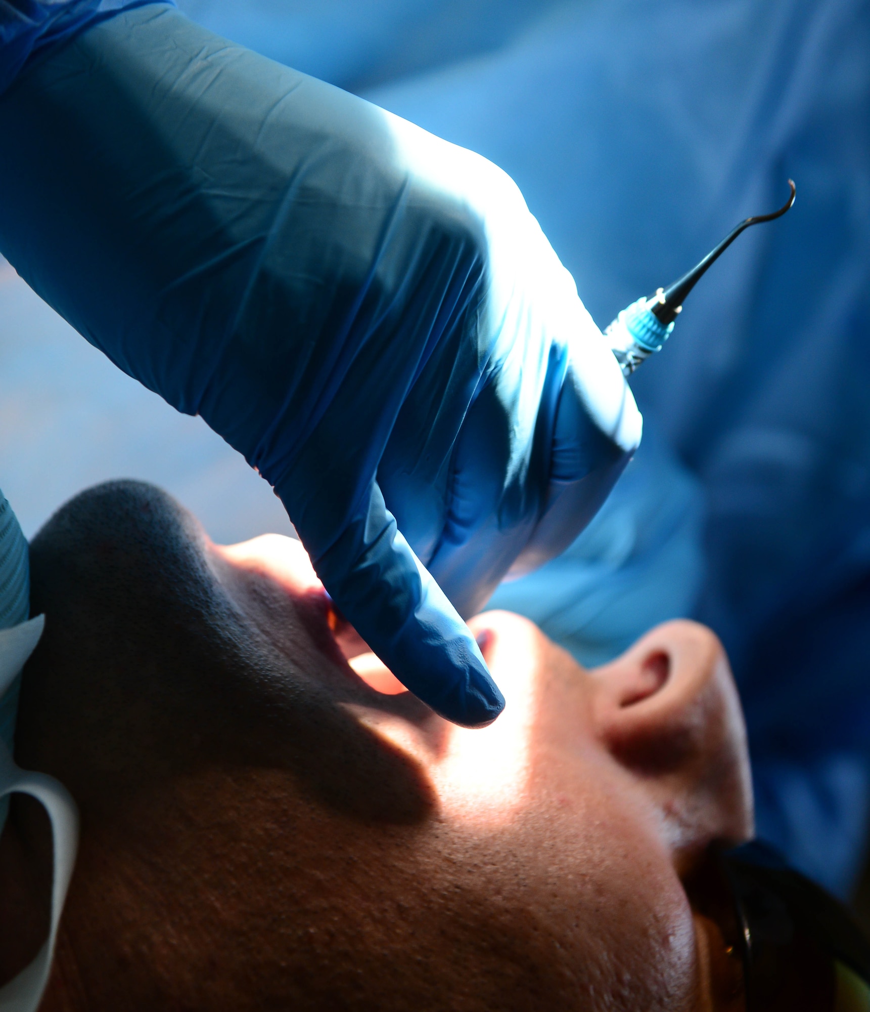 Staff Sgt. David Tierney, 2nd Dental Squadron dental technician, uses a scraper to remove plaque from a patient’s teeth at Barksdale Air Force Base, La., Sept. 14, 2016. In addition to routine cleaning, the 2nd DS also provides nightguards, retainers, crowns, bridges and implants for patient’s teeth. (U.S. Air Force photo/Senior Airman Luke Hill)