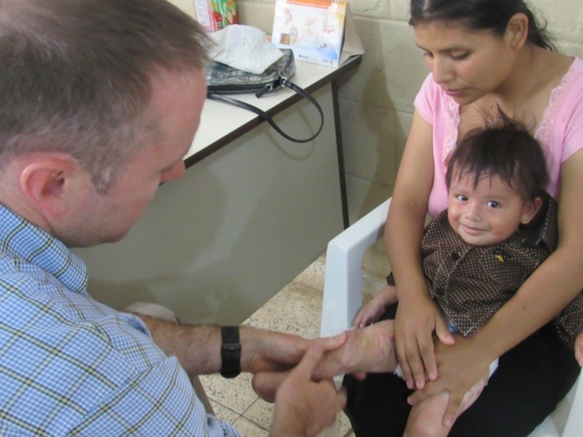 U.S. Army Maj. Jonathan Reagan, Joint Task Force Bravo Medical Element physical therapist, is applying a low load, static stretch technique to an eight-month-old burn victim during a weekly visit to Centro de Rehabilitación Integral de Comayagua, August 3, 2016, where he treats Honduran patients and provides follow-up care for their rehabilitation process. JTF-Bravo regularly partners with the partner nation Ministries of Health to provide various levels and types of medical care in a variety of locations throughout Central America, to include physical therapy, trauma, preventive medicine and dental. (U.S. Army photo by 1st Lt Jenniffer Rodriguez) 