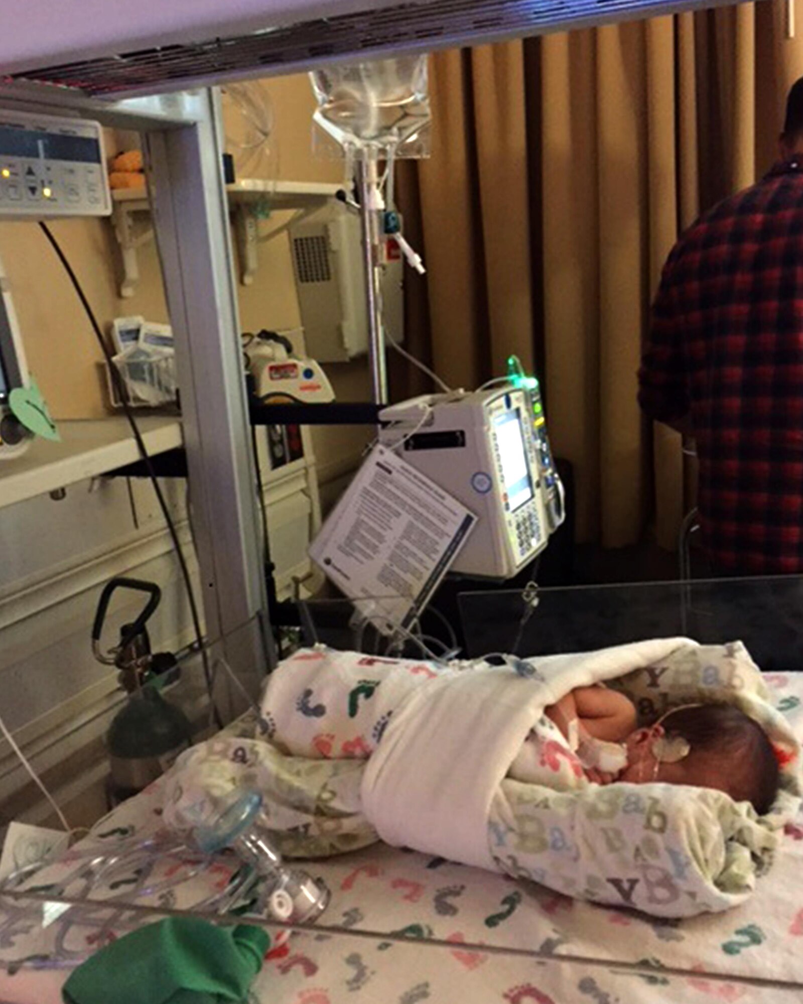COLORADO SPRINGS, Colo. – One of the Edwards-Aagaard twin boys is prepped for one of many surgeries in the neonatal intensive care unit in Colorado Springs, Colo., Oct. 21, 2015. The twins, born to Staff Sgt. Susan Edwards-Aagaard, 21st Operations Support Squadron intelligence analyst, had Twin-to-Twin Transfusion Syndrome and have battled medical challenges since birth. (Courtesy photo)