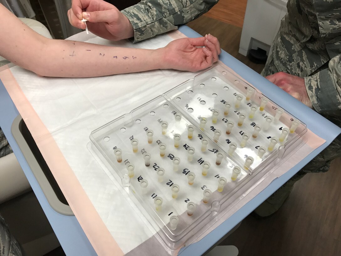 SrA Matthew Howard-Dahrling, 779th Medical Group medical technician conducts allergy testing on a patient to identify environmental allergens. (photo by Ms. Monica Soper)