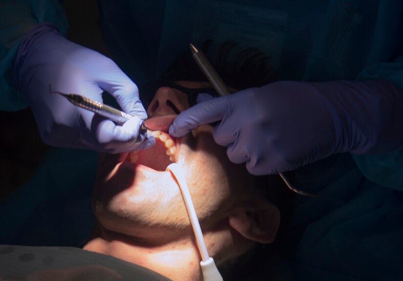 Staff Sgt. Kaitlynne Anzur, 779th Medical Group dental assistant, cleans a patients teeth following a dental check-up at Joint Base Andrews, Md., April 18, 2017. Dental assistants support general dentistry, periodontics, prosthodontics, orthodontics, endodontics and oral surgery while seeing approximately 2,000 patients a month. (U.S. Air Force photo by Senior Airman Mariah Haddenham)
