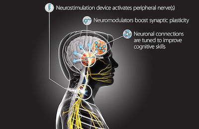 This Targeted Neuroplasticity Training concept diagram demonstrates how the Defense Advanced Research Projects Agency program will explore using peripheral nerve stimulation to enhance learning processes in the brain. DARPA will fund research teams from seven universities and partner with elements of the Air Force and Army to execute the program. DARPA graphic