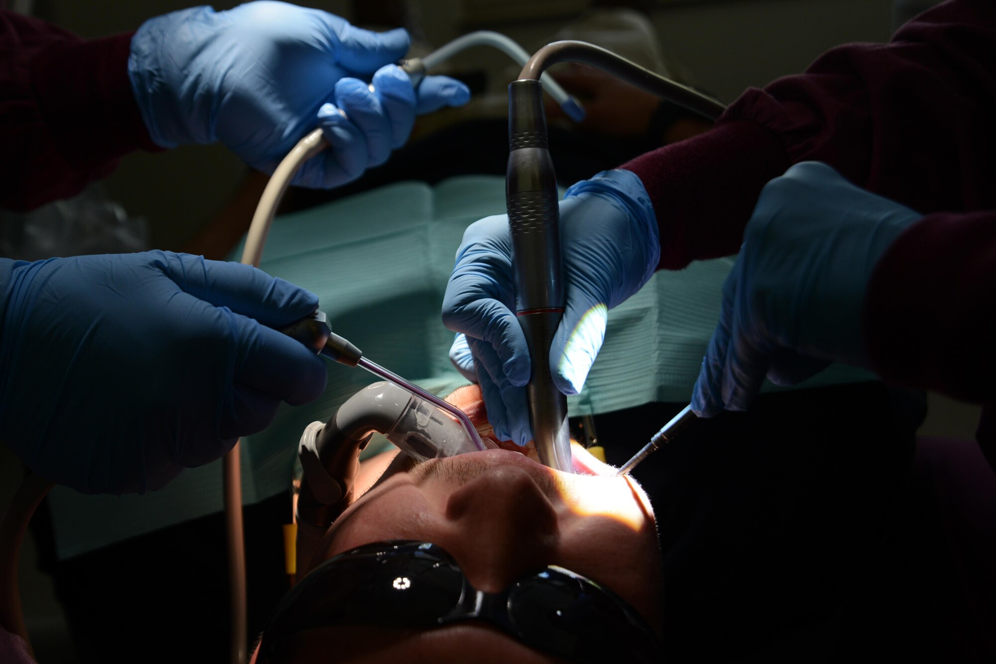 Air Force Maj. Nicole Smith (right), 673d Dental Squadron prosthodontist, and Senior Airman Lauren Francis, 673d DS technician (left), prepare Airman 1st Class Ian McKinney’s, 673d Security Forces Squadron alarm monitor specialist, teeth for a temporary crown at the Joint Base Elmendorf-Richardson Hospital, Alaska, Aug. 14, 2017. A cavity or incomplete tooth needs a crown to prevent further damage. The dentist removes any decay and the outer layer of the tooth so the crown fits like a cap.