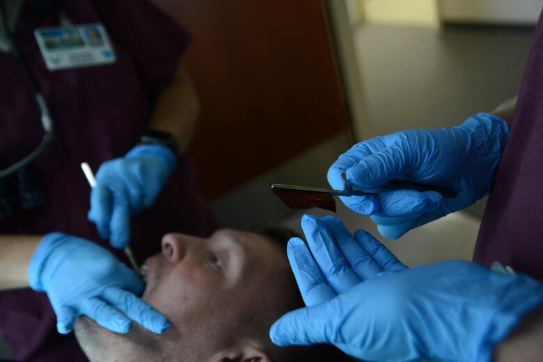 Senior Airman Lauren Francis (right), 673d Dental Squadron dental technician, checks the articulating paper to assure the temporary crown won’t grind the other teeth of Airman 1st Class Ian McKinney, 673d Security Forces Squadron alarm monitor specialist, at the Joint Base Elmendorf-Richardson Hospital, Alaska, Aug. 14, 2017. A cavity or incomplete tooth needs a crown to prevent further damage. The dentist removes any decay and the outer layer of the tooth so the crown fits like a cap.