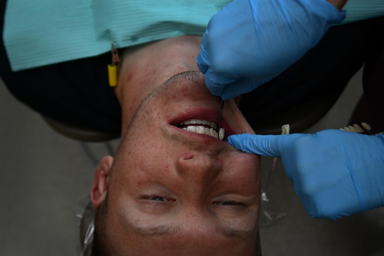 Air Force Maj. Nicole Smith (right), 673d Dental Squadron prosthodontist, compares Airman 1st Class Ian McKinney’s, 673d Security Forces Squadron alarm monitor specialist, temporary crown with a test tooth at the Joint Base Elmendorf-Richardson Hospital, Alaska, Aug. 14, 2017. A cavity or incomplete tooth needs a crown to prevent further damage. The dentist removes any decay and the outer layer of the tooth so the crown fits like a cap.