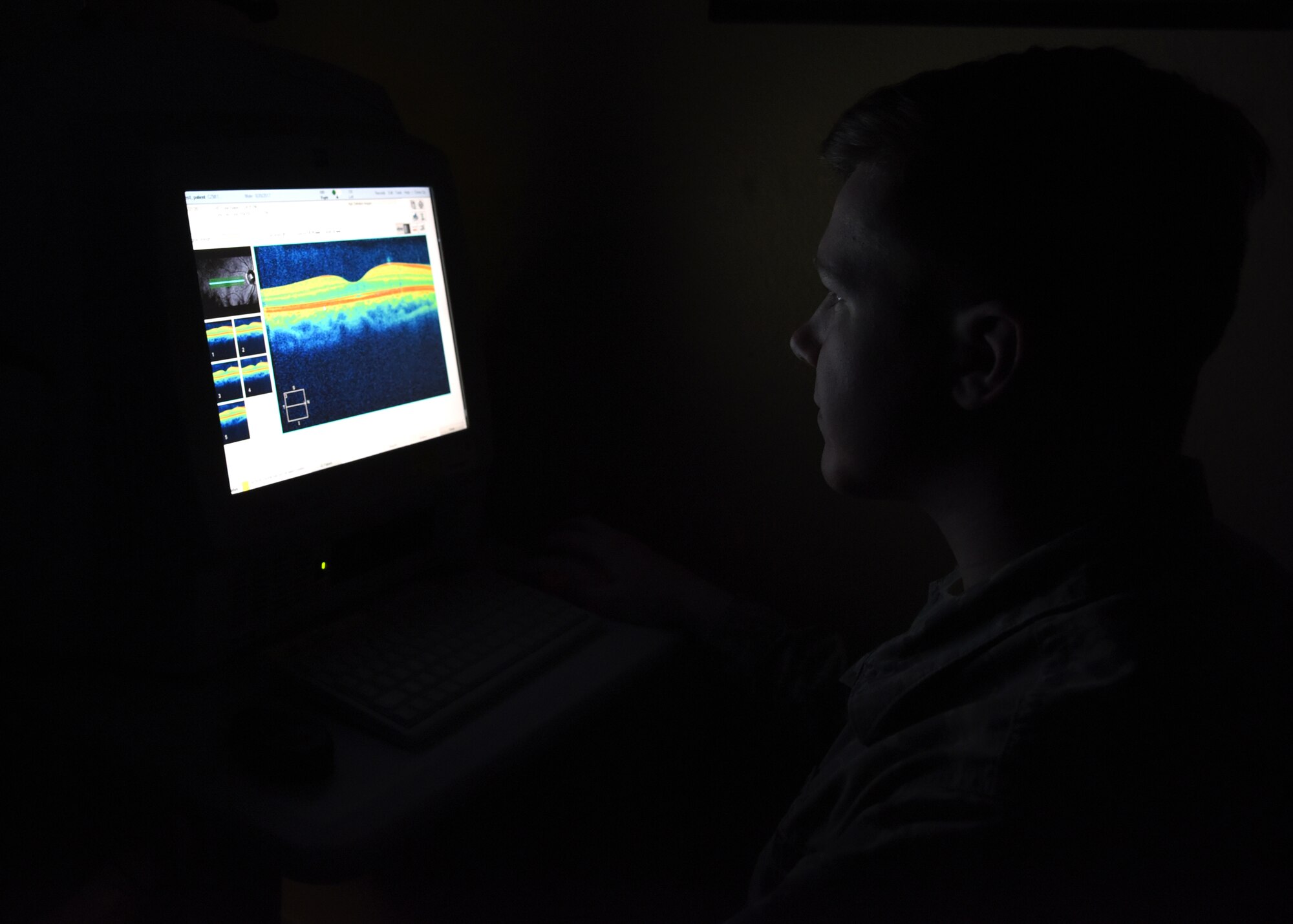 5th MDOS: point of view