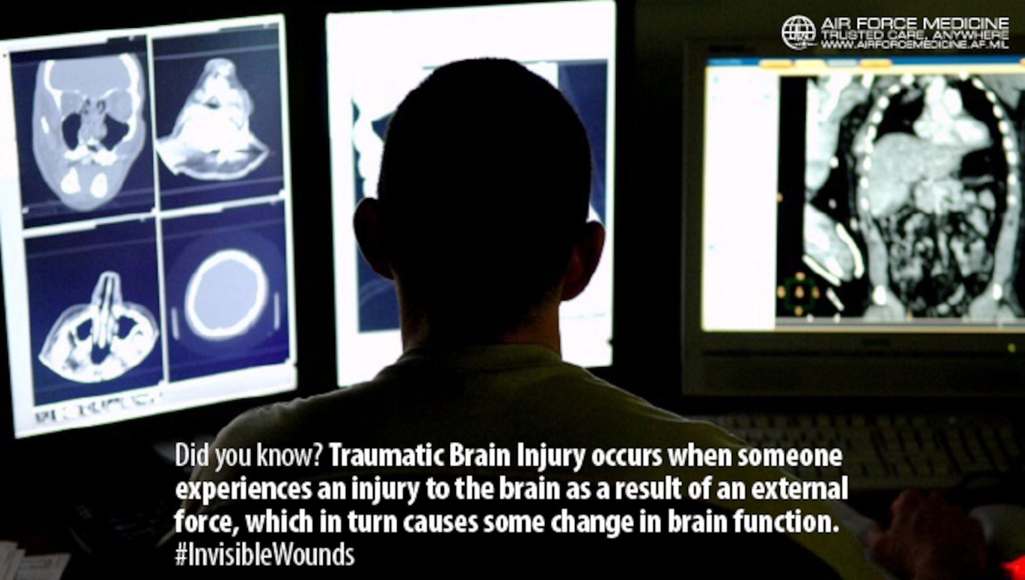 Traumatic Brain Injury (TBI) can be difficult to detect with its typical lack of physical markers. Knowing the signs and symptoms of TBI is critical and ensures Airmen can return to duty. (U.S. Air Force photo)