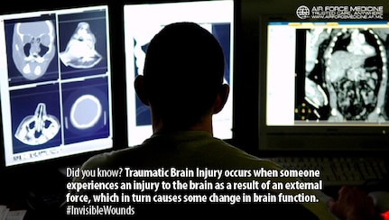 Traumatic Brain Injury (TBI) can be difficult to detect with its typical lack of physical markers. Knowing the signs and symptoms of TBI is critical and ensures Airmen can return to duty. (U.S. Air Force photo)