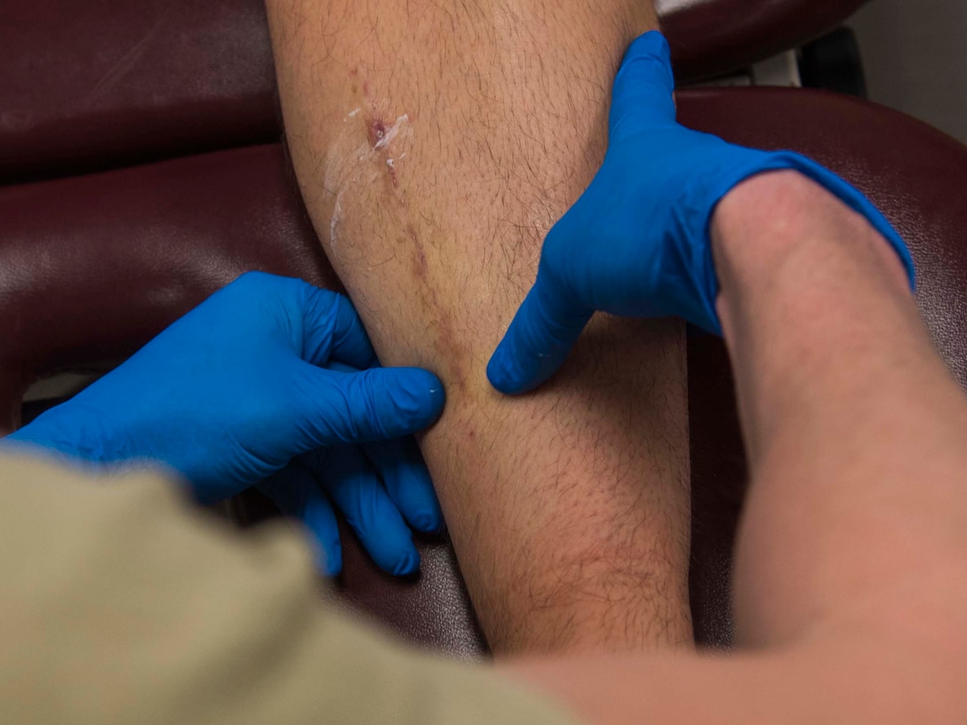 Staff Sgt. Kivynn Pabst, 779th Medical Group physical medicine technician, massages a patient’s leg during a physical therapy session at Joint Base Andrews, Md., Feb. 2, 2017. Technicians provide quality patient care in an ethical, safe, sanitary and caring environment. (U.S. Air Force photo by Airman 1st Class Valentina Lopez)