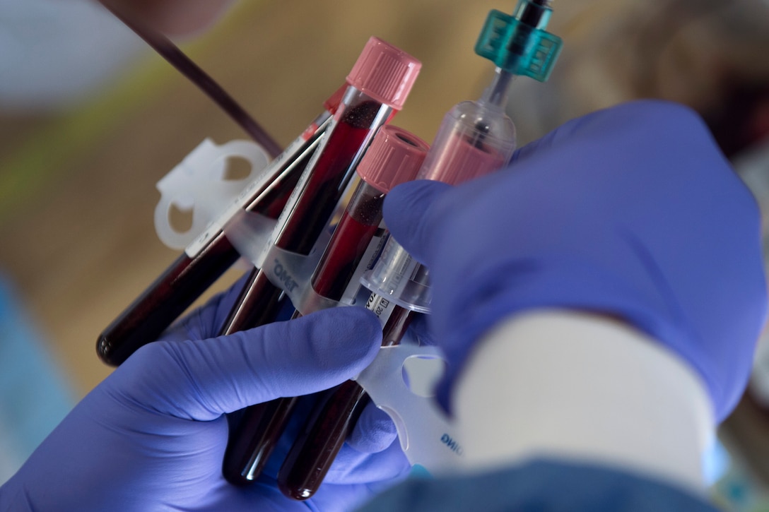 Blood pumps into test tubes during the Armed Services Blood Bank Center’s blood donation on Joint Base Andrews, Md., Feb. 6, 2017. The test tubes are used to test for blood-borne pathogens in order to make sure the approximately 450 to 500 milliliters of blood donated is safe to be used when needed. (U.S. Air Force photo by Senior Airman Philip Bryant)