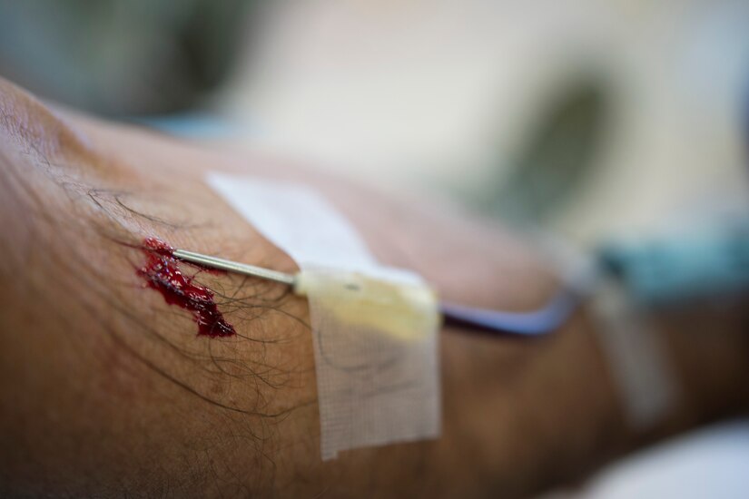 A needle is inserted in the arm of a donor during the Armed Services Blood Bank Center’s blood donation on Joint Base Andrews, Md., Feb. 6, 2017. The ASBBC collects blood donations at more than 50 different locations in the National Capital Region. (U.S. Air Force photo by Senior Airman Philip Bryant)