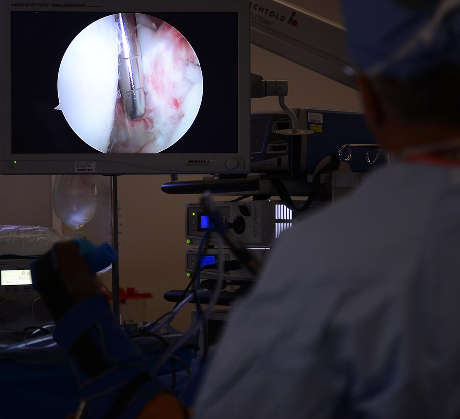 Harry Warren, McDonald Army Health Center orthopedic surgeon, uses a shaver and camera inside a patient’s shoulder to shave away unnecessary material in the shoulder during an operation at Joint Base Langley-Eustis, Va., Jan. 31, 2017. The surgical section of MCAHC is an outpatient ambulatory setting, supporting surgeries from clinics such as orthopedic, podiatry, gynecology, gastroenterology and ophthalmology. (U.S. Air Force photo by Staff Sgt. Teresa J. Cleveland)