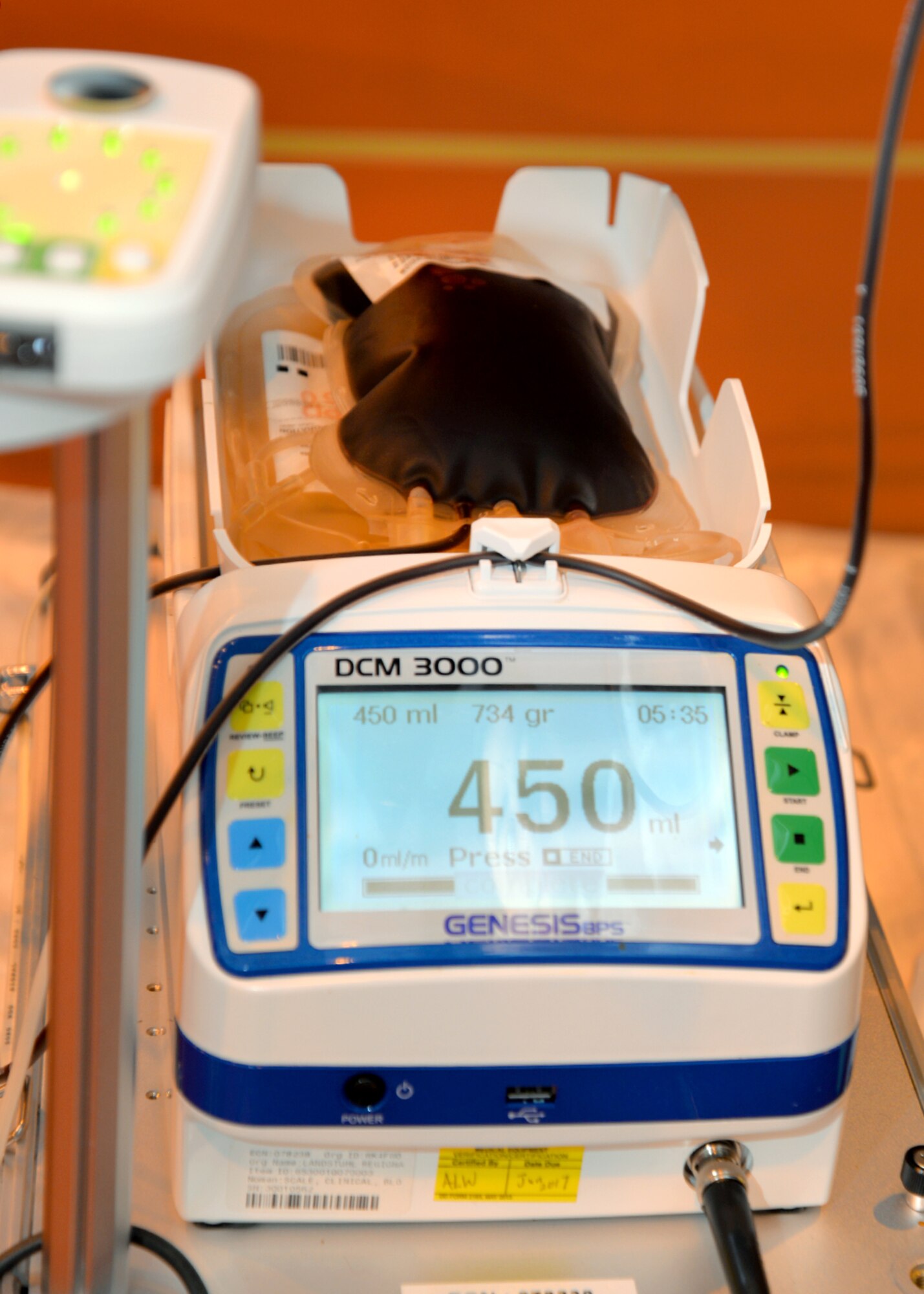 A pint of blood is weighed out on a blood-rocker scale during a military member’s donation session Feb. 7, 2017, on RAF Mildenhall, England. A medical team from Landstuhl Regional Medical Center, Germany, visited RAF Mildenhall and RAF Lakenheath to conduct the Armed Services Blood Program blood drive. (U.S. Air Force photo by Karen Abeyasekere)