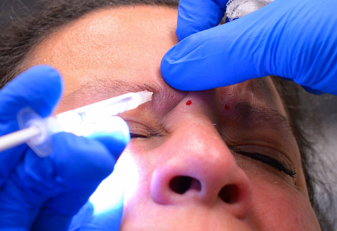 Lt. Col. Chester Barton, 374th Ear Nose and Throat Clinic otolaryngologist, administers Botox shots to Master Sgt. Danira Estrada, 374th Logistics Readiness Squadron section chief at Yokota Air Base, Japan, Feb. 16, 2017. Botox shots treat migraines by relaxing muscles that cause pain. Treating migraines is one of the many ways Yokota’s ENT clinic helps personnel keep doing their jobs happily and in good health. (U.S. Air Force photo by Senior AirmanElizabeth Baker)