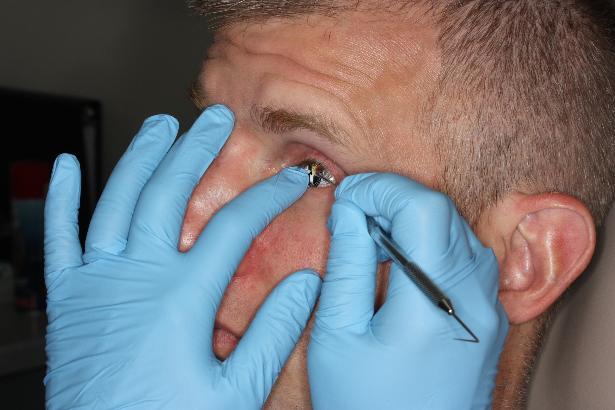 Lt. Col. Kenneth Dwyer, patient and Special Forces officer assigned to U.S. Army 1st Special Forces Command (Airborne), get his new prosthetic eye with his unit's crest checked at the Air Force Postgraduate Dental School on Joint Base San Antonio-Lackland, Texas, Nov. 17, 2016. Dwyer commands an elite unit of Army green berets and rangers at Fort Bragg, North Carolina. (Courtesy photo) 