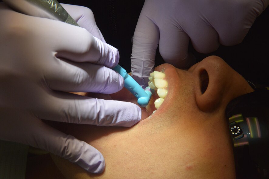 An Airman receives a dental cleaning at Minot Air Force Base, N.D., Jan. 10, 2017. Dental polishing removes stains, plaque accumulation and increases aesthetics. (U.S. Air Force photo/Airman 1st Class Jessica Weissman)