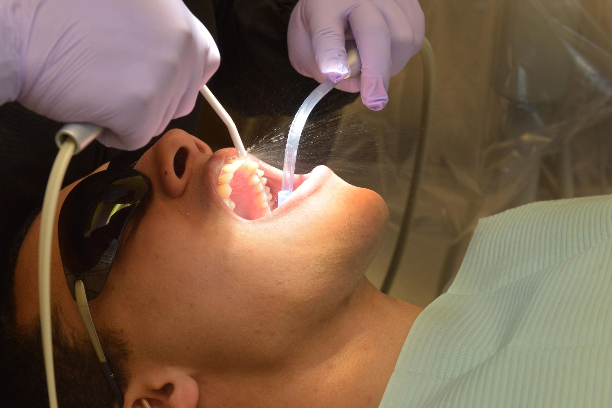 An Airman receives a dental cleaning at Minot Air Force Base, N.D., Jan. 10, 2017. Dental polishing removes stains, plaque accumulation and increases aesthetics. (U.S. Air Force photo/Airman 1st Class Jessica Weissman)