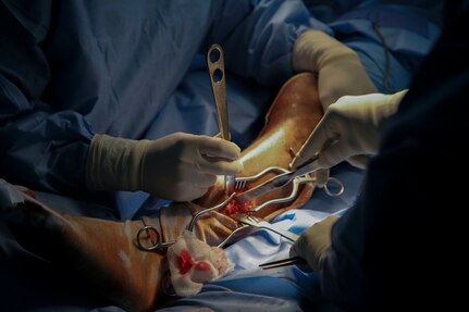 Senegalese surgeon Boubacar Mbaye and Vermont Air National Guard surgeon Maj. Anthony Donaldson conduct a leg realignment surgery during Medical Readiness Training Exercise 17-1 at Hospital Militaire De Ouakam in Dakar, Senegal, Jan. 17, 2017. MEDRETE is a combined effort between the Senegalese government, U.S. Army Africa, the U.S. Army Reserve 332nd Medical Brigade in Nashville, Tenn., and the Vermont Air National Guard. MEDRETE 17-1 is the first in a series of medical readiness training exercises that U.S. Army Africa is scheduled to facilitate within various countries in Africa, and serves as an opportunity for the partnered militaries to hone and strengthen their general surgery and trauma skills while reinforcing the partnership between the countries. The mutually beneficial exercise brings together Senegalese military and U.S. Army medical professionals to foster cooperation while conducting medical specific tasks. 