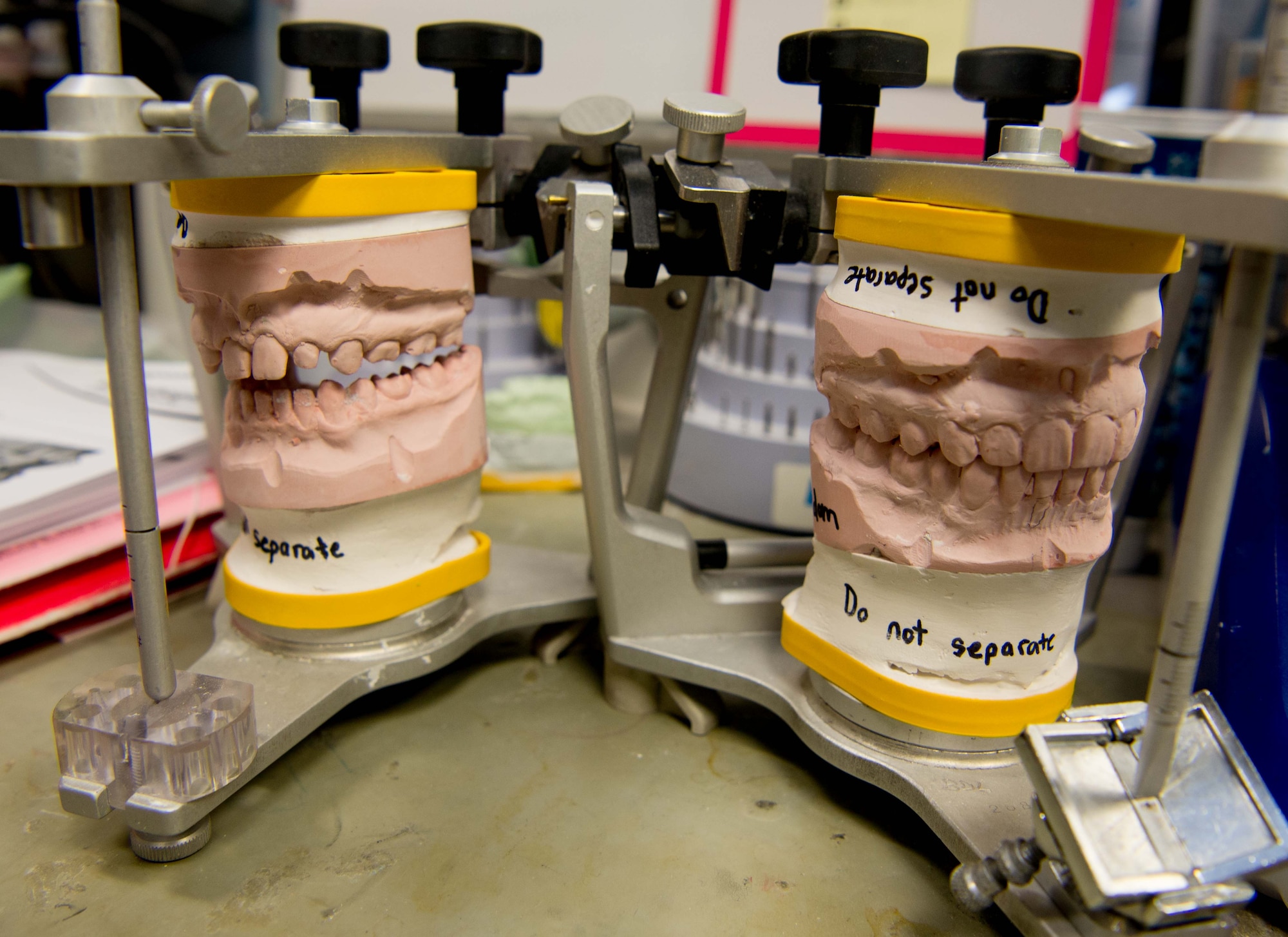 A cast of a patient’s original teeth, left, sits beside a cast of his new artificial teeth at the 86th Dental Squadron on Ramstein Air Base, Germany, July 25, 2016. The 86th DS continues to search for innovative ways to fix damaged or defective dental structure in faster, safer and smarter ways. (U.S. Air Force photo by Senior Airman Elizabeth Baker)