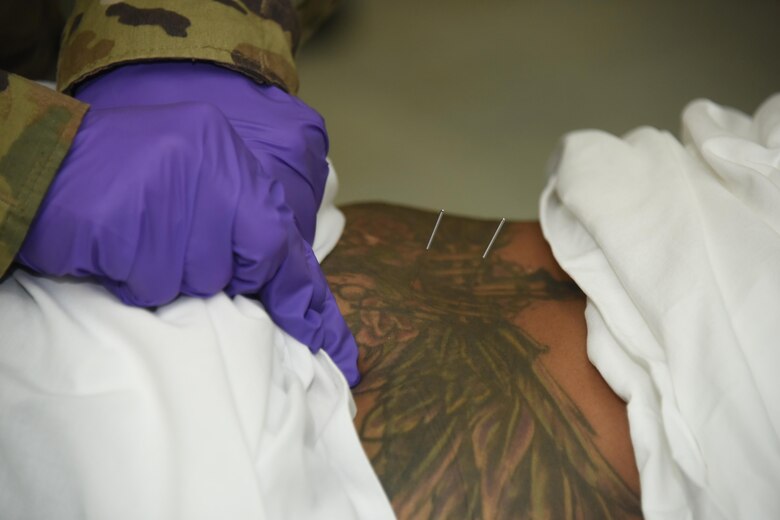 Capt. Grant Tong, the 386th Expeditionary Medical Group physical therapy element chief, conducts dry needling treatment on a patient during a physical therapy session at an undisclosed location in Southwest Asia, June 11, 2017. The physical therapy clinic provides an array of rehabilitative services to promote movement, reduce pain, restore function and prevent disability of injured military personnel. (U.S. Air Force photo/Tech. Sgt. Jonathan Hehnly)