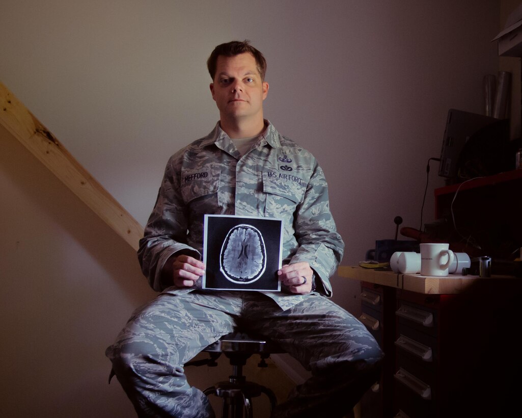 Tech. Sgt. Lucas Mefford, 11th Civil Engineer explosive ordinance disposal craftsman, holds a scan of his brain at Joint Base Andrews, Md., May 29, 2017.  Mefford attended an inpatient program at the National Intrepid Center of Excellence program, in Bethesda, Md., for depression, insomnia, and other symptoms caused by a traumatic brain injury. He continues his medical treatment at JBA and hopes to influence his Airmen to be advocates for their health. (U.S. Air Force photo by Senior Airman Mariah Haddenham)