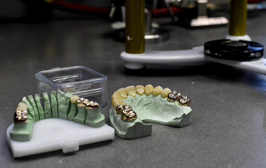 A set of caps for teeth rests on a table at the 86th Dental Squadron Area Dental Lab on Ramstein Air Base, Germany, June 21, 2017. Chris York, 86th Dental Squadron dental lab technician, made 25 caps out of gold and two different types of porcelain for a Soldier as part of the lab’s joint partnership with the U.S. Army. (U.S. Air Force photo by Senior Airman Tryphena Mayhugh) 