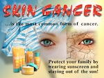 Too much exposure to the sun’s ultraviolet rays over time can lead to skin cancer, which is responsible for thousands of deaths each year in the United States. It is also the most common cancer in the U.S., according to the American Academy of Dermatology.