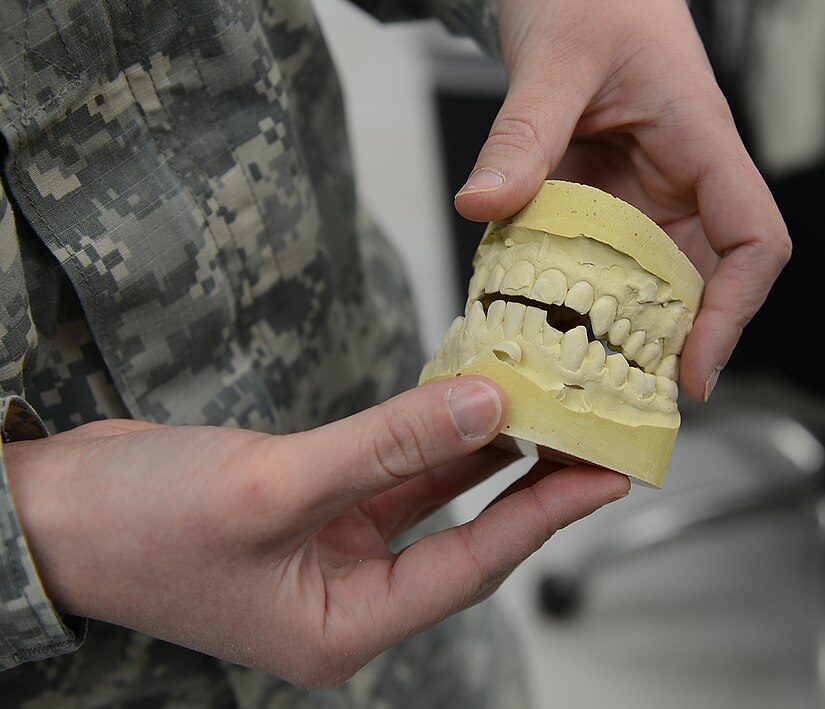 U.S. Army Sgt. Nicole Lewis, U.S. Army Dental Command dental laboratory NCO, inspects a patient’s dental model at the Tignor Dental Clinic at Joint Base Langley-Eustis, Va., March 10, 2017. The clinic houses a laboratory where dentures, veneers and crowns are fabricated for patients. (U.S. Air Force photo/Staff Sgt. Teresa J. Cleveland)