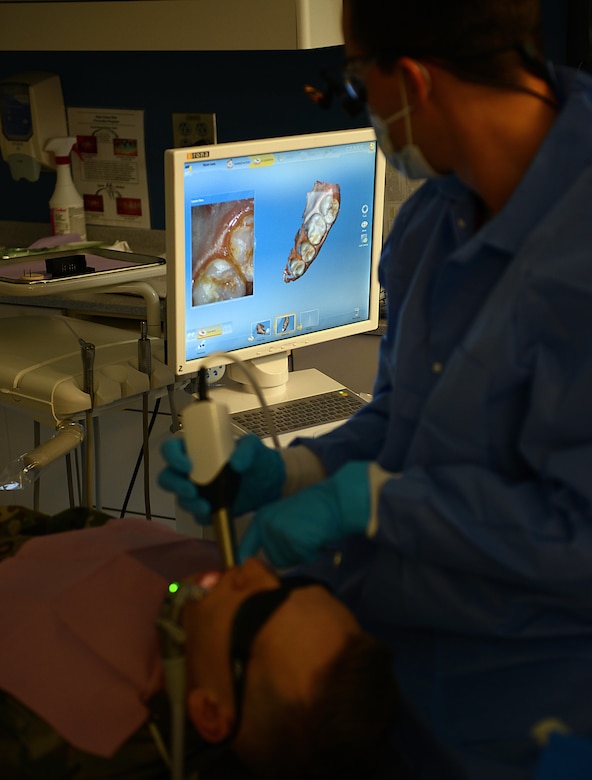 U.S. Army Capt. Tyler Oatmen, U.S. Army Dental Command dentist, takes scans of a patient’s mouth at the Tignor Dental Clinic at Joint Base Langley-Eustis, Va., March 10, 2017. The clinic can now perform a root canal and place a crown during one appointment by utilizing newer technology, compared to a four-appointment process used in the past. (U.S. Air Force photo/Staff Sgt. Teresa J. Cleveland)