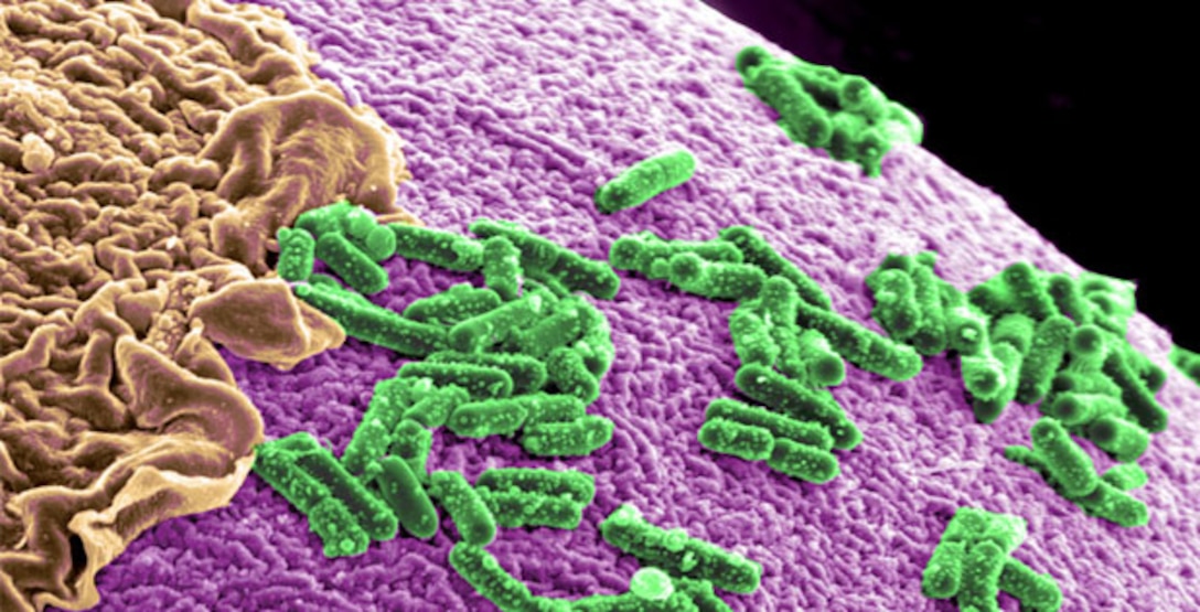 Potential applications of synthetic biology range from on-demand bioproduction of novel drugs, fuels and coatings, to the ability to engineer microbes capable of optimizing human health by preventing or treating disease. DoD photo