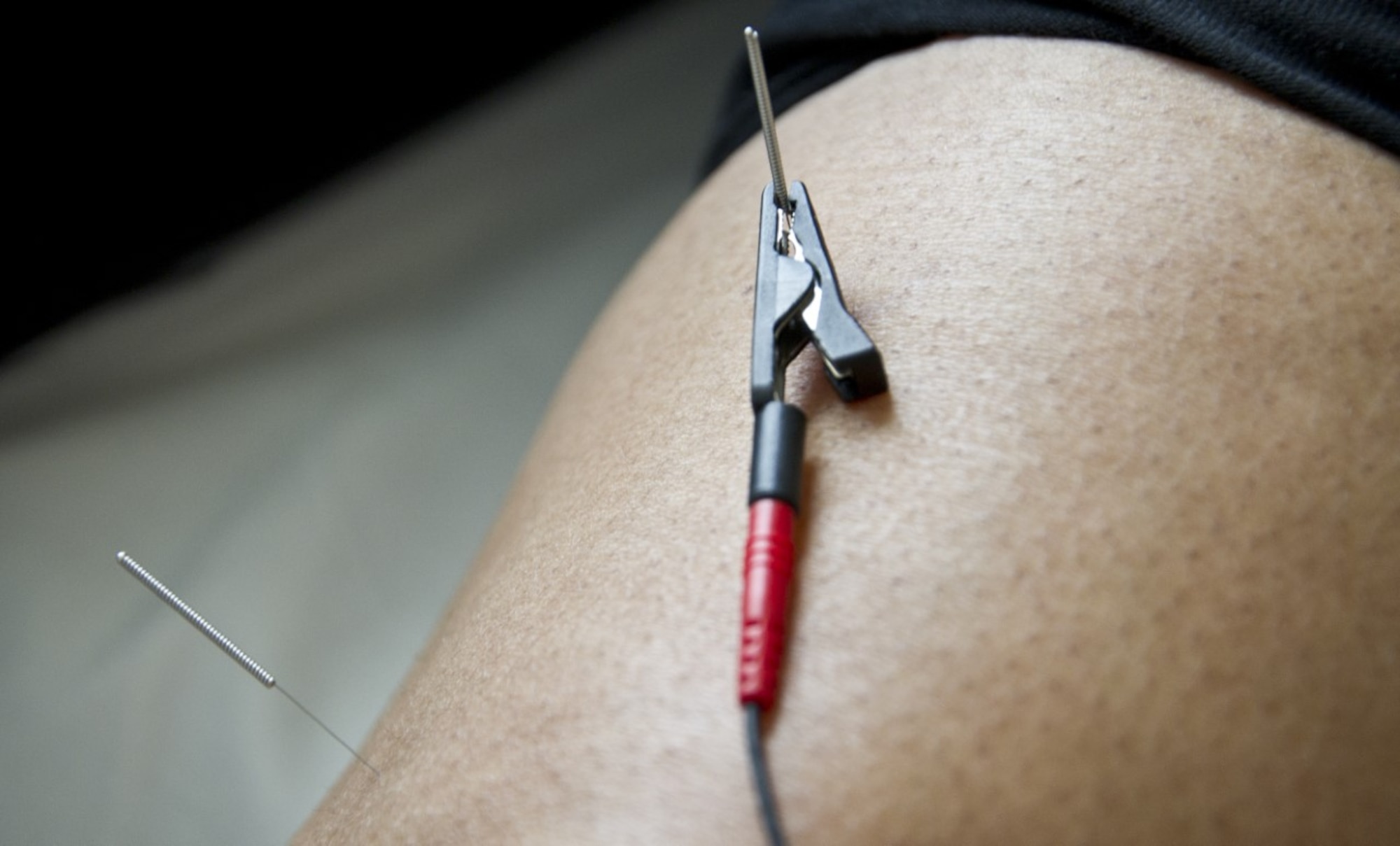 A positive lead transmitting an electrical pulse clings to a needle inserted into the leg of a patient March 28, 2017 at the Air Force Acupuncture and Integrative Medicine Clinic at Joint Base Andrews, Md. With the electro-acupuncture technique, an electrical pulse helps relieve muscle tension and stimulates natural anti-pain chemicals throughout a patient’s body. (U.S. Air Force photo by Staff Sgt. Joe Yanik)