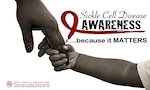 Sickle Cell Awareness