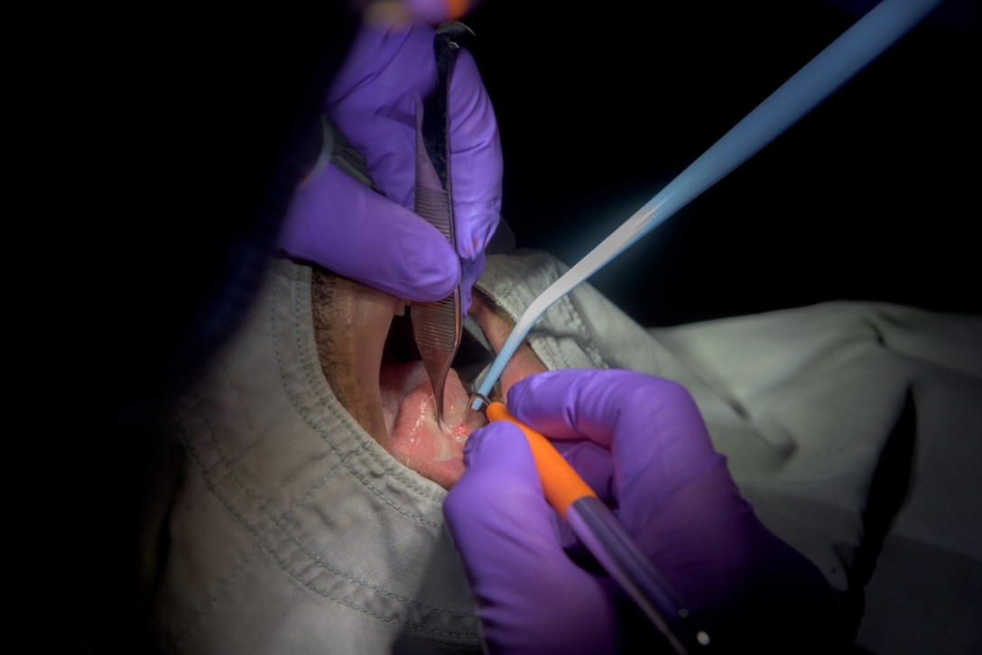 Navy Capt. Jaime Quejada, left, dental officer of the aircraft carrier USS Ronald Reagan; and Navy Petty Officer 3rd Class Davondrion Compton, right, a hospital corpsman from Bunkie, La., perform the first oral-laser surgery aboard the ship, May 22, 2017. Quejada performed an oral frenectomy on Navy Petty Officer 3rd Class Steven Wright, from Newark, N.J. Navy photo by Petty Officer 2nd Class Nathan Burke